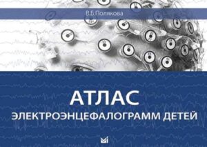 Атлас электроэнцефалограмм детей