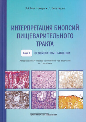 Интерпретация биопсий пищеварительного тракта. Неопухолевые болезни. Том 1