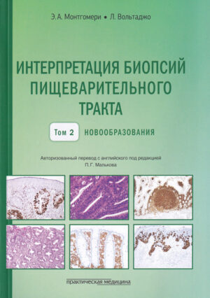 Интерпретация биопсий пищеварительного тракта. Новообразования. Том 2.