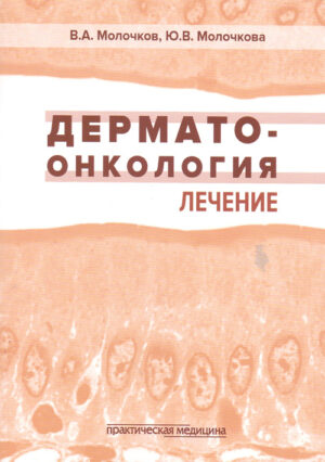 Дерматоонкология. Лечение
