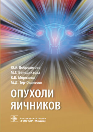 Опухоли яичников