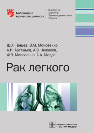 Рак легкого