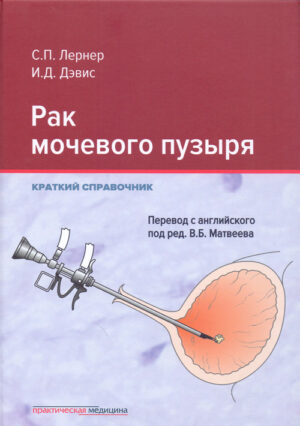 Рак мочевого пузыря