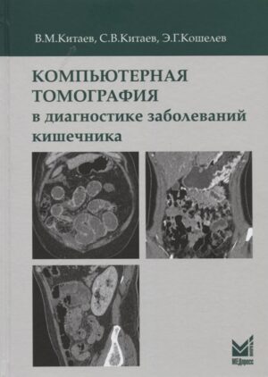 Компьютерная томография в диагностике заболеваний кишечника