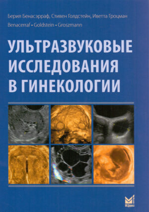 Ультразвуковые исследования в гинекологии
