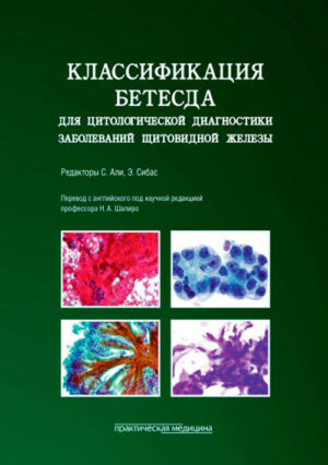 Классификация Бетесда для цитологической диагностики заболеваний щитовидной железы: терминология, критерии и пояснения