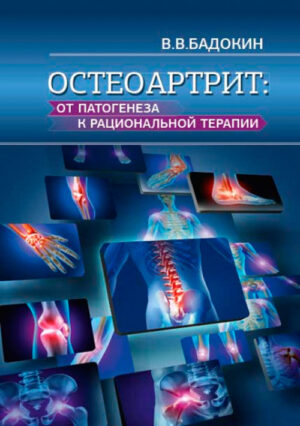 Остеоартрит: от патогенеза к рациональной терапии