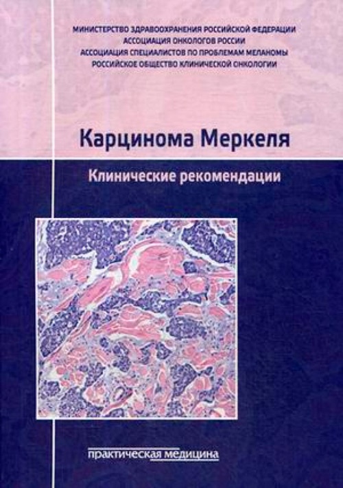 Карцинома Меркеля. Клинические рекомендации