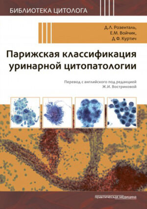 Парижская классификация уринарной цитопатологии