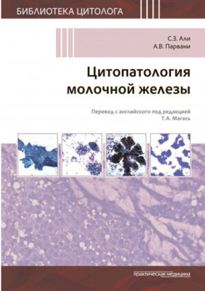 Цитопатология молочной железы