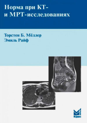 Норма при КТ- и МРТ- исследованиях