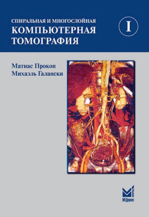 Спиральная и многослойная компьютерная томография. 1 том