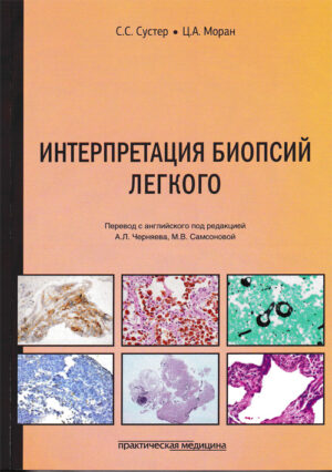 Интерпретация биопсий легкого