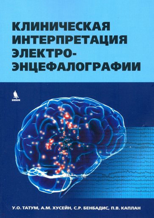 Клиническая интерпретация электроэнцефалографии