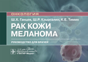 Рак кожи. Меланома