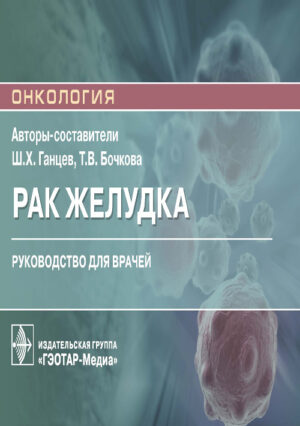 Рак желудка