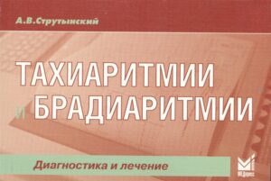 Тахиаритмии и брадиаритмии. Диагностика и лечение