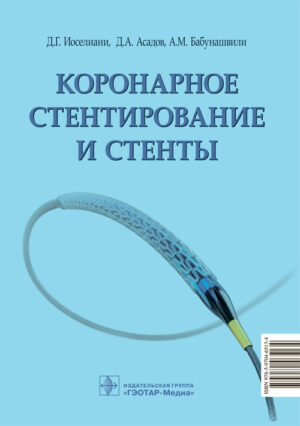 Коронарное стентирование и стенты