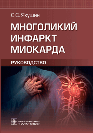 Многоликий инфаркт миокарда
