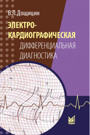 Электрокардиографическая дифференциальная диагностика