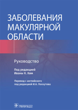 Заболевания макулярной области