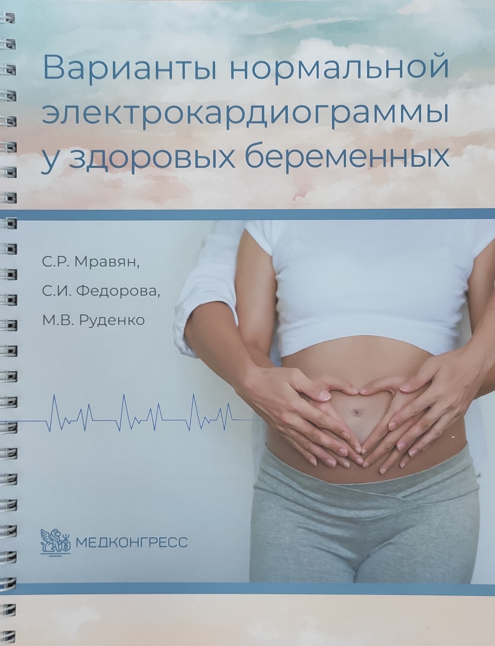 Варианты нормальной электрокардиограммы у здоровых беременных