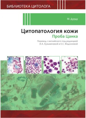Цитопатология кожи. Проба Цанка