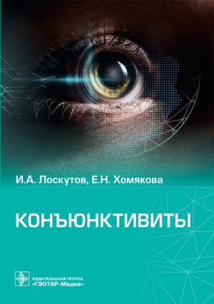 Конъюнктивиты