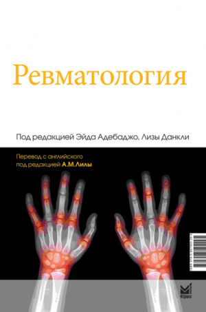 Ревматология