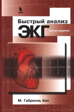 Быстрый анализ ЭКГ