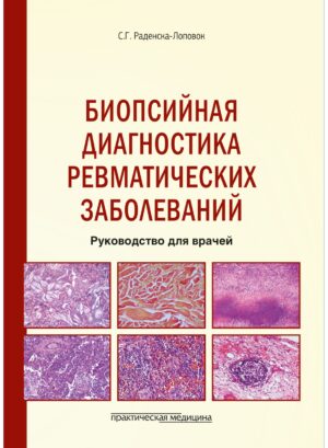 Биопсийная диагностика ревматических заболеваний. Руководство для врачей