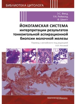 Йокогамская система интерпретации результатов тонкоигольной аспирационной биопсии молочной железы