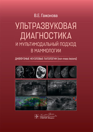 Ультразвуковая диагностика и мультимодальный подход в маммологии. Диффузные неузловые патологии (non-mass lesions)