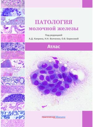 Патология молочной железы. Атлас