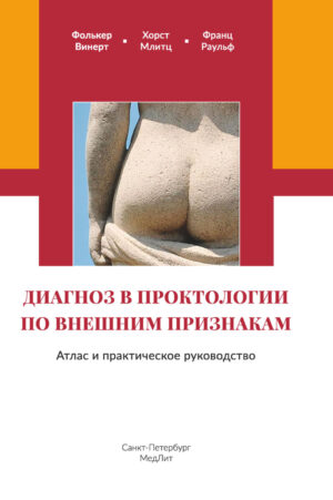 Диагноз в проктологии по внешним признакам