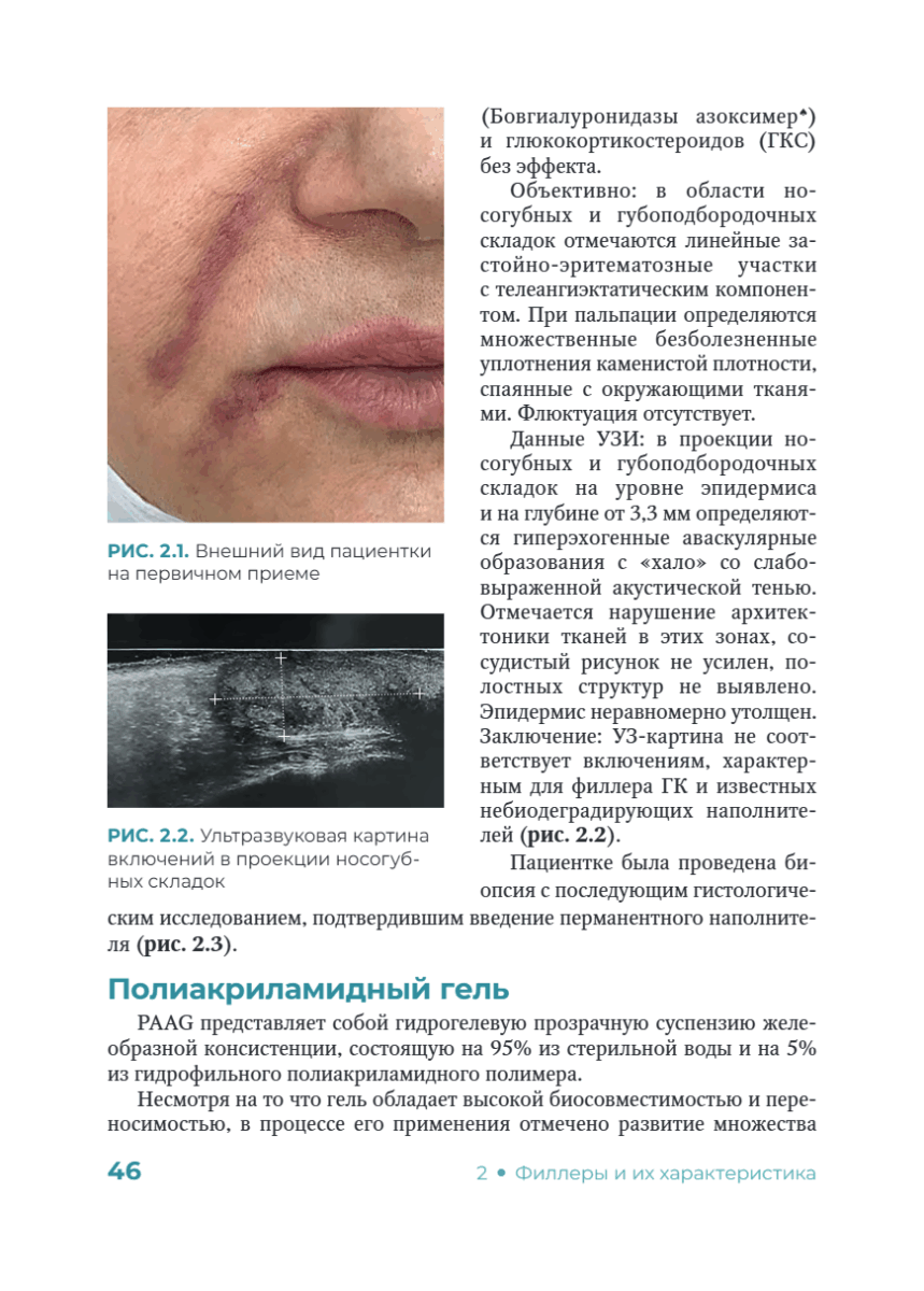 Постинъекционные осложнения в косметологии — изображение 2