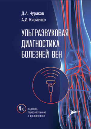 Ультразвуковая диагностика болезней вен