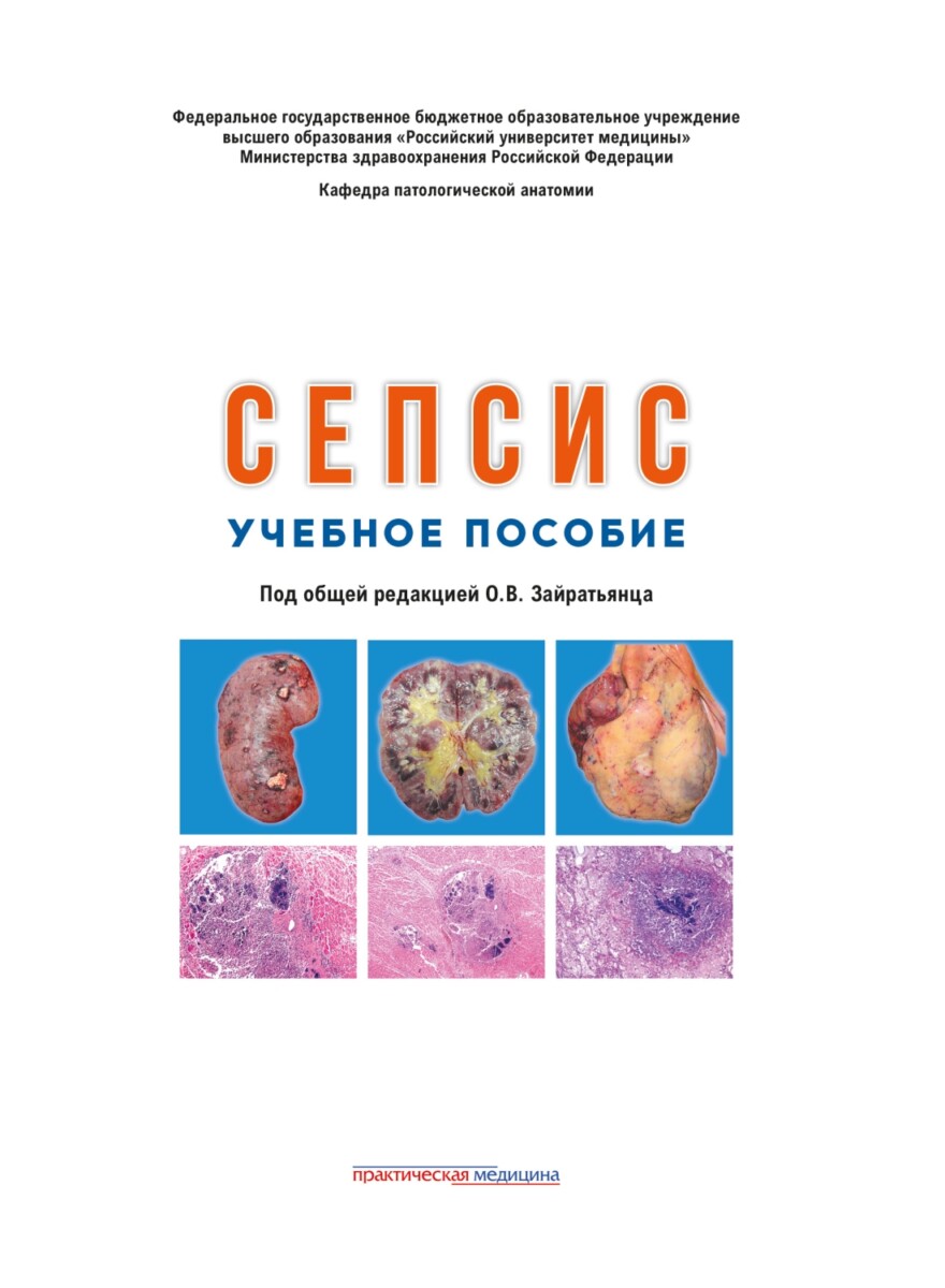 Сепсис. Учебное пособие