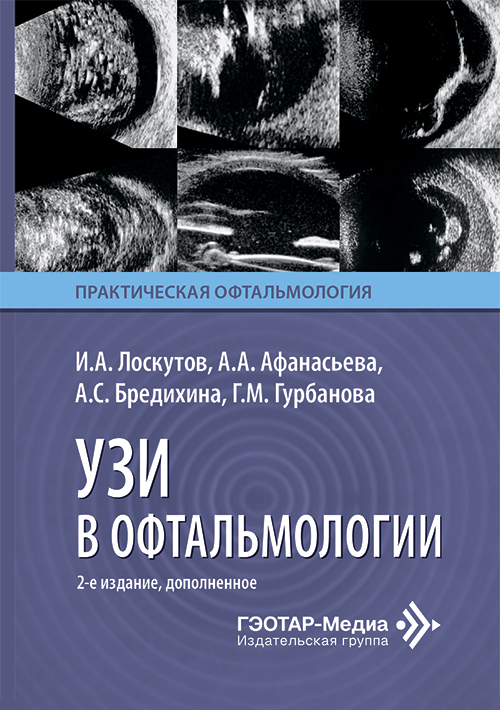 УЗИ в офтальмологии