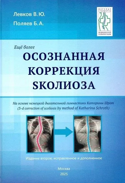 Осознанная коррекция сколиоза