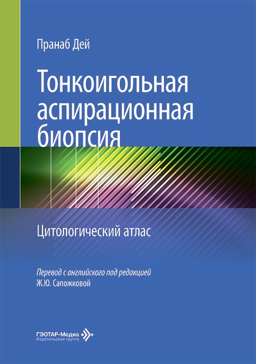 Тонкоигольная аспирационная биопсия. Цитологический атлас