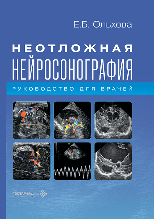 Неотложная нейросонография. Руководство