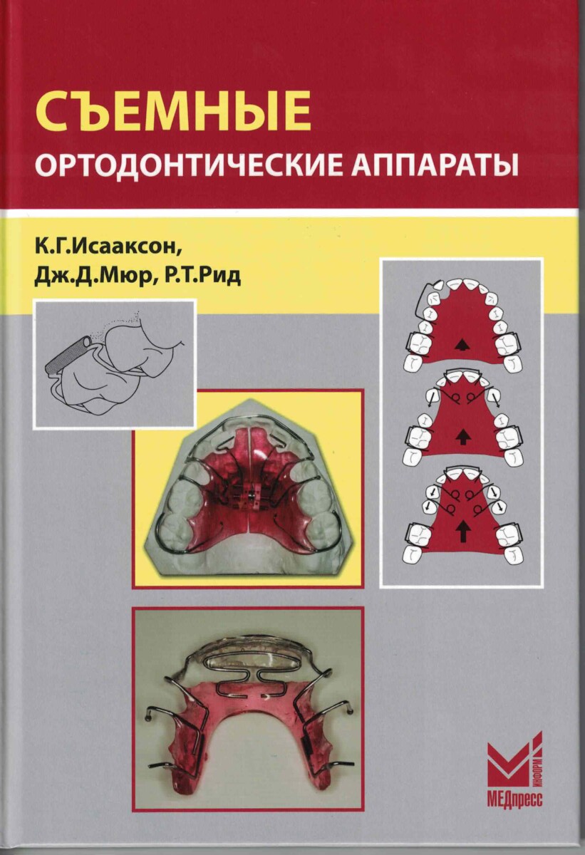 Съемные ортодонтические аппараты