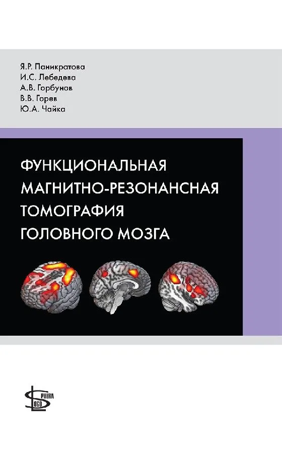 Функциональная магнитно-резонансная томография головного мозга