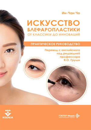 Искусство блефаропластики. От классики до инноваций